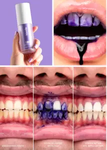 Hismile Process
